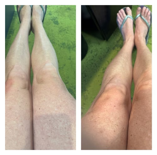 Customer photo review of Self Tanning | 150 Capsules for Sunless Skin Glow