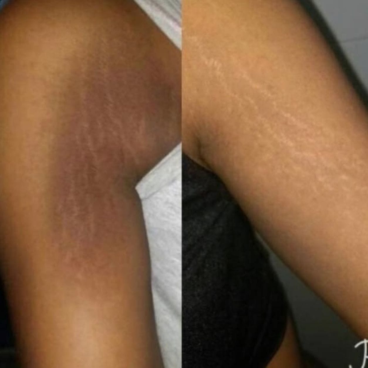 Customer photo review of Striae Glow Bar