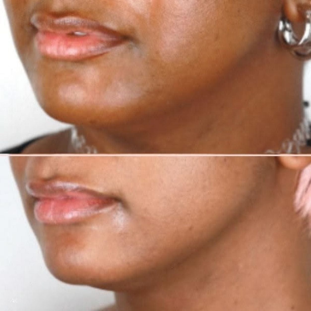 Customer photo review of Darkspots Glow Serum