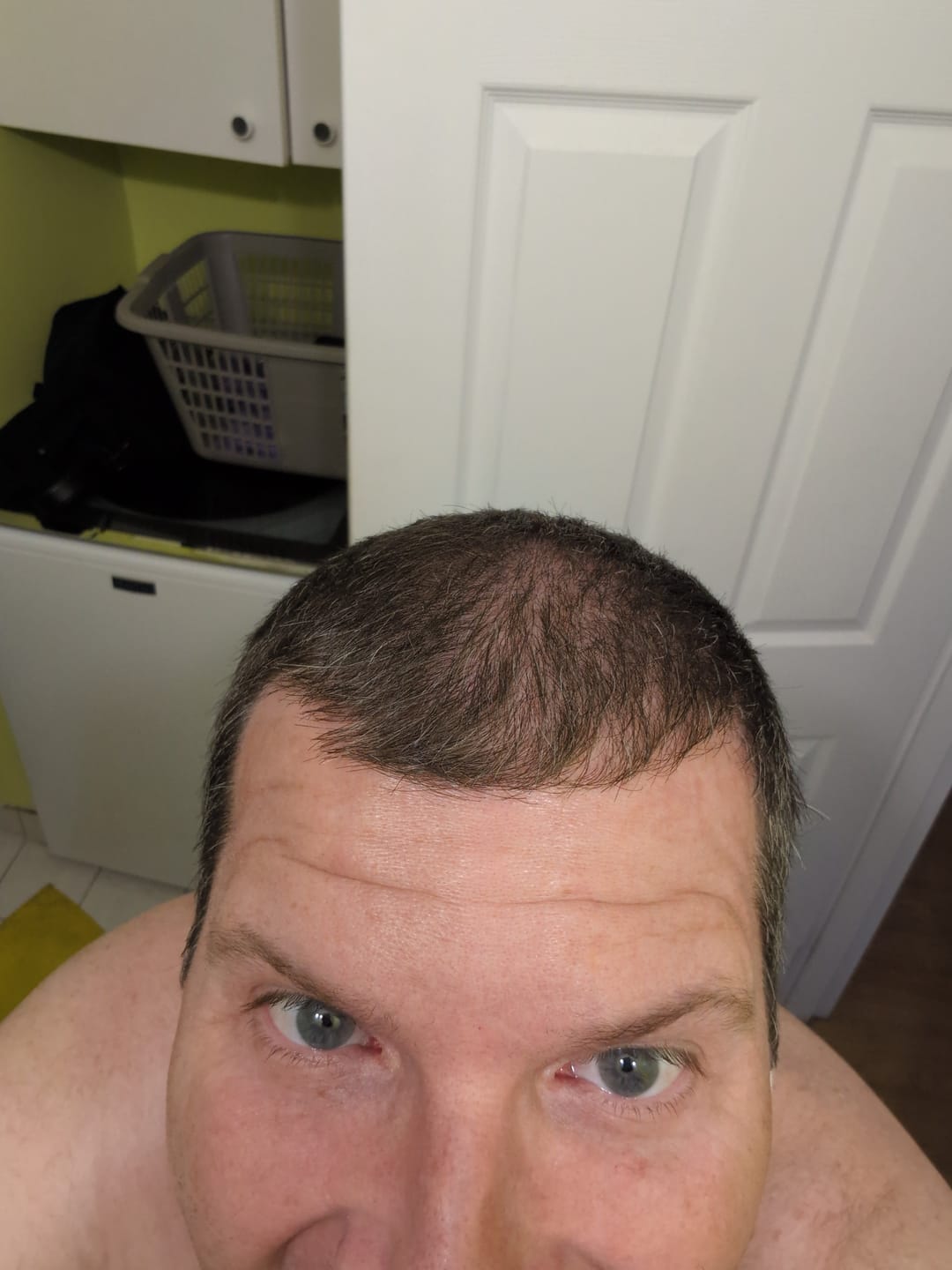 Customer photo review of Shampoing Celestine  — Activation Des Racines Et Repousse Pour Les Hommes