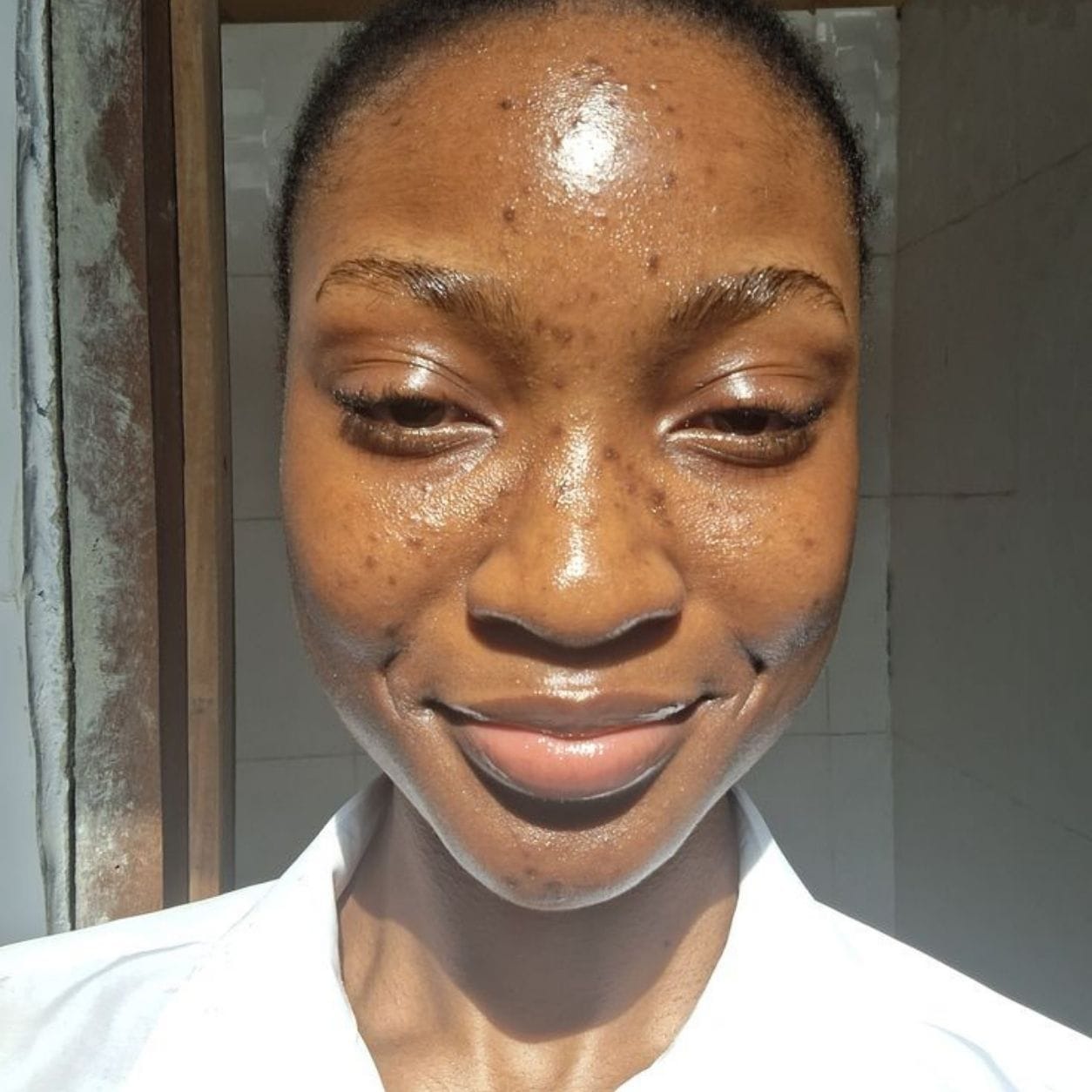 Customer photo review of Hyperpigmentation Glow Face Wash