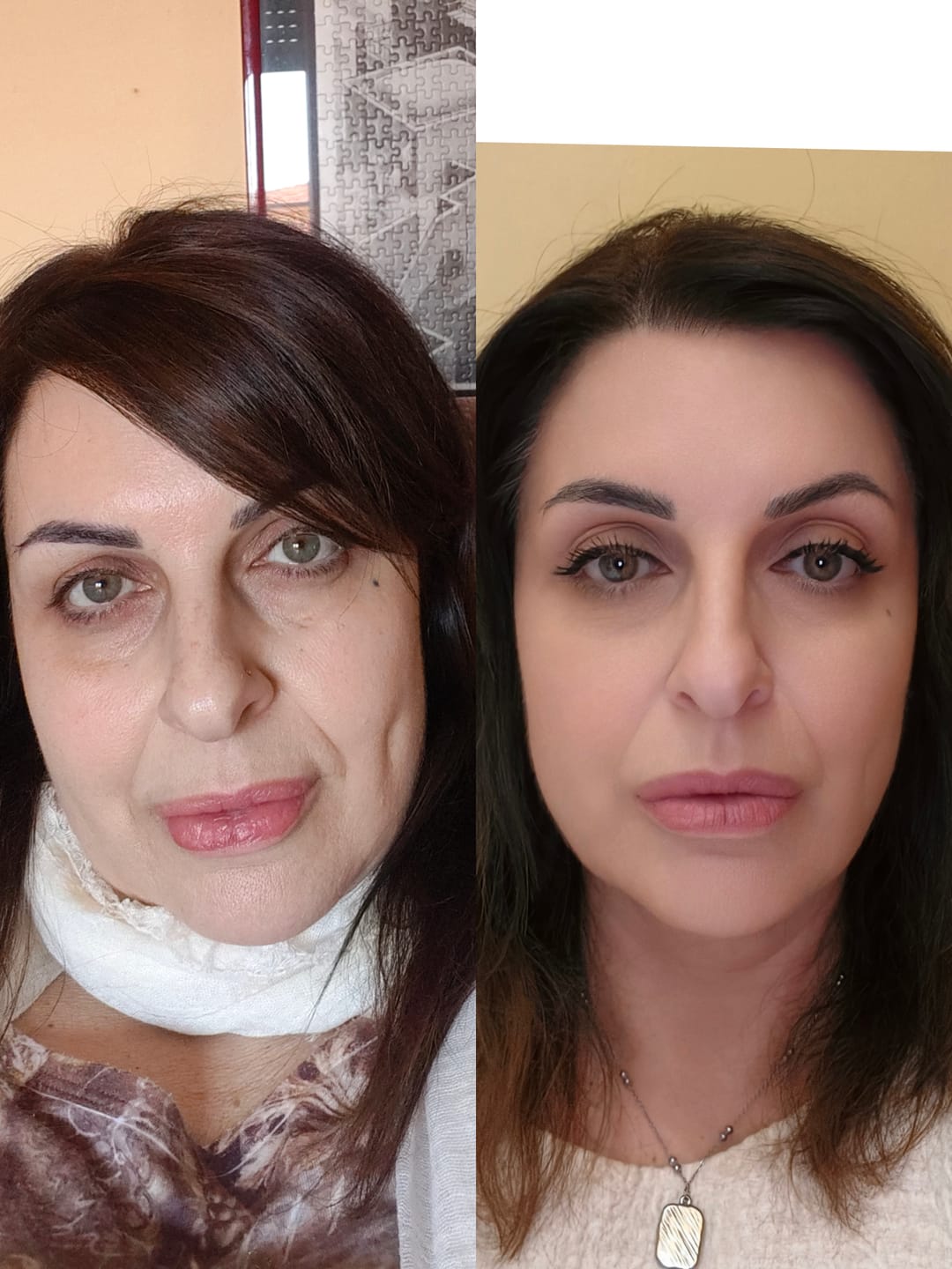 Customer photo review of BioChroma – Siero Coreano Effetto Lifting dalla Prima Applicazione
