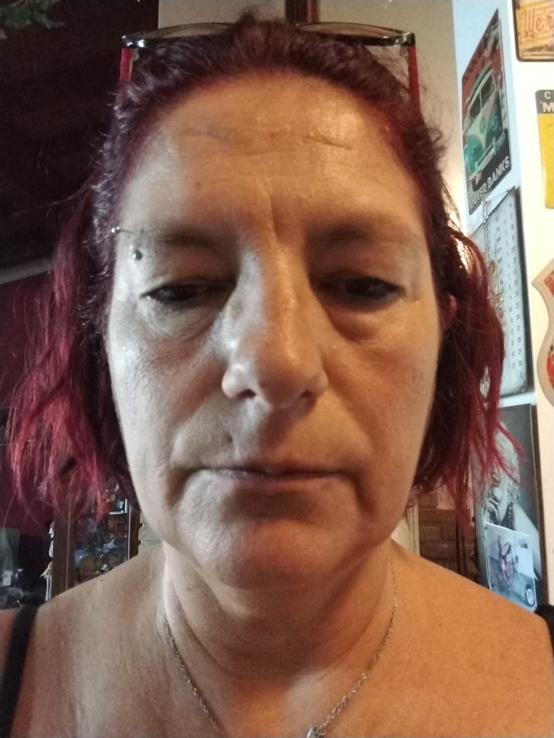 Customer photo review of BioChroma – Siero Coreano Effetto Lifting dalla Prima Applicazione