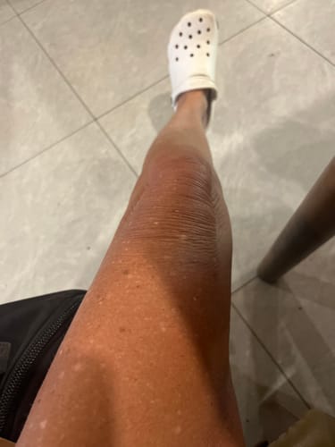 Customer photo review of Self Tanning | 150 Capsules for Sunless Skin Glow