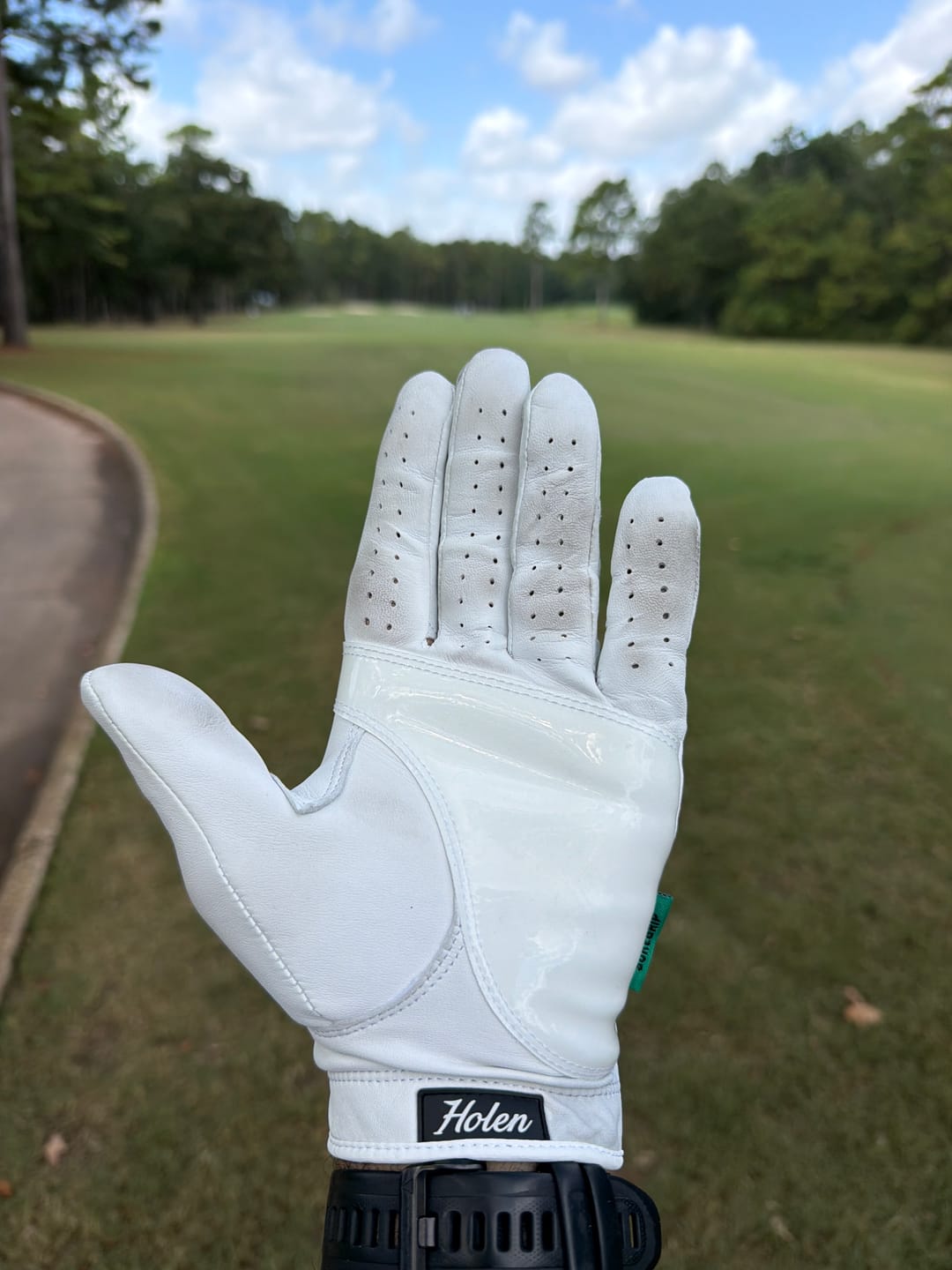 Customer photo review of Holen SureGrip Glove