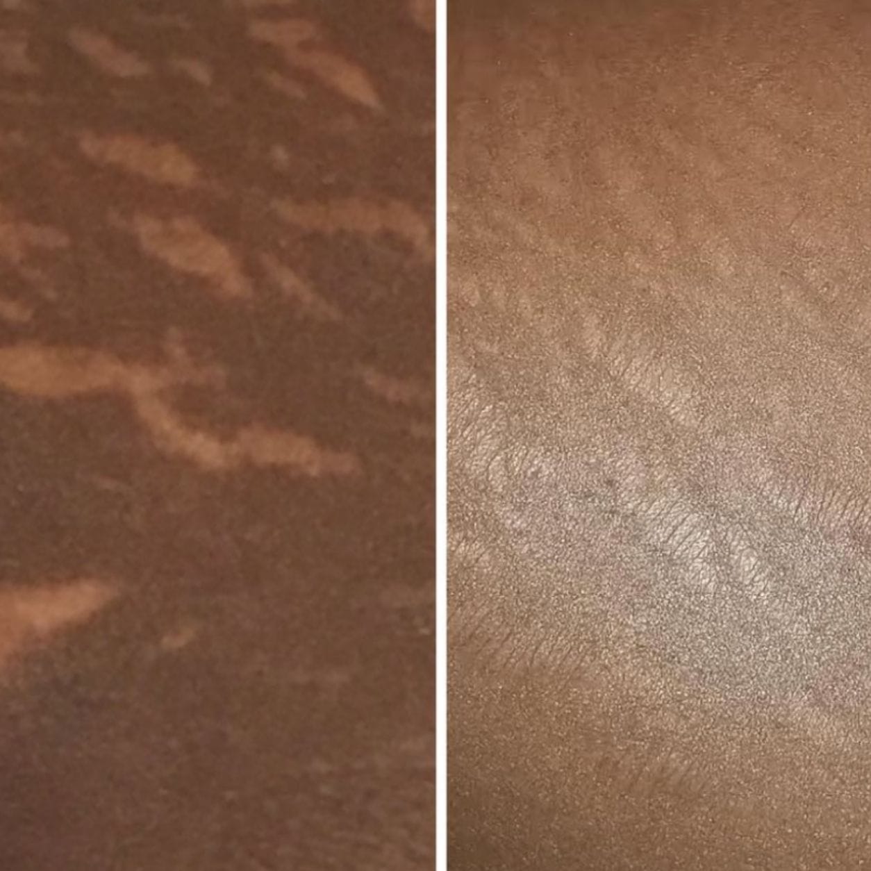Customer photo review of Glowing Skin Routine: Glow Essentials