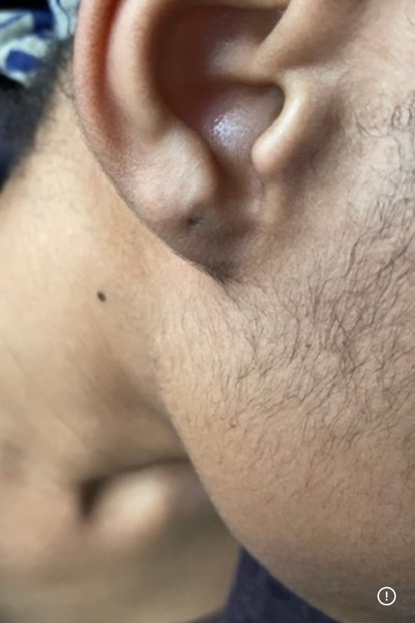 Customer photo review of Minoxidil 5% Solution, 1 x 60ml pack