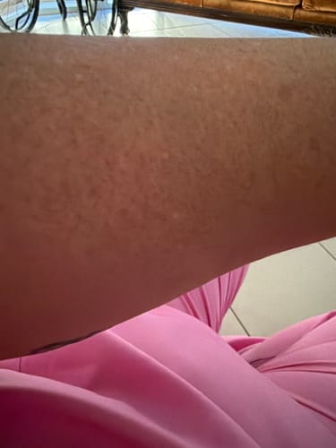 Customer photo review of Self Tanning | 150 Capsules for Sunless Skin Glow
