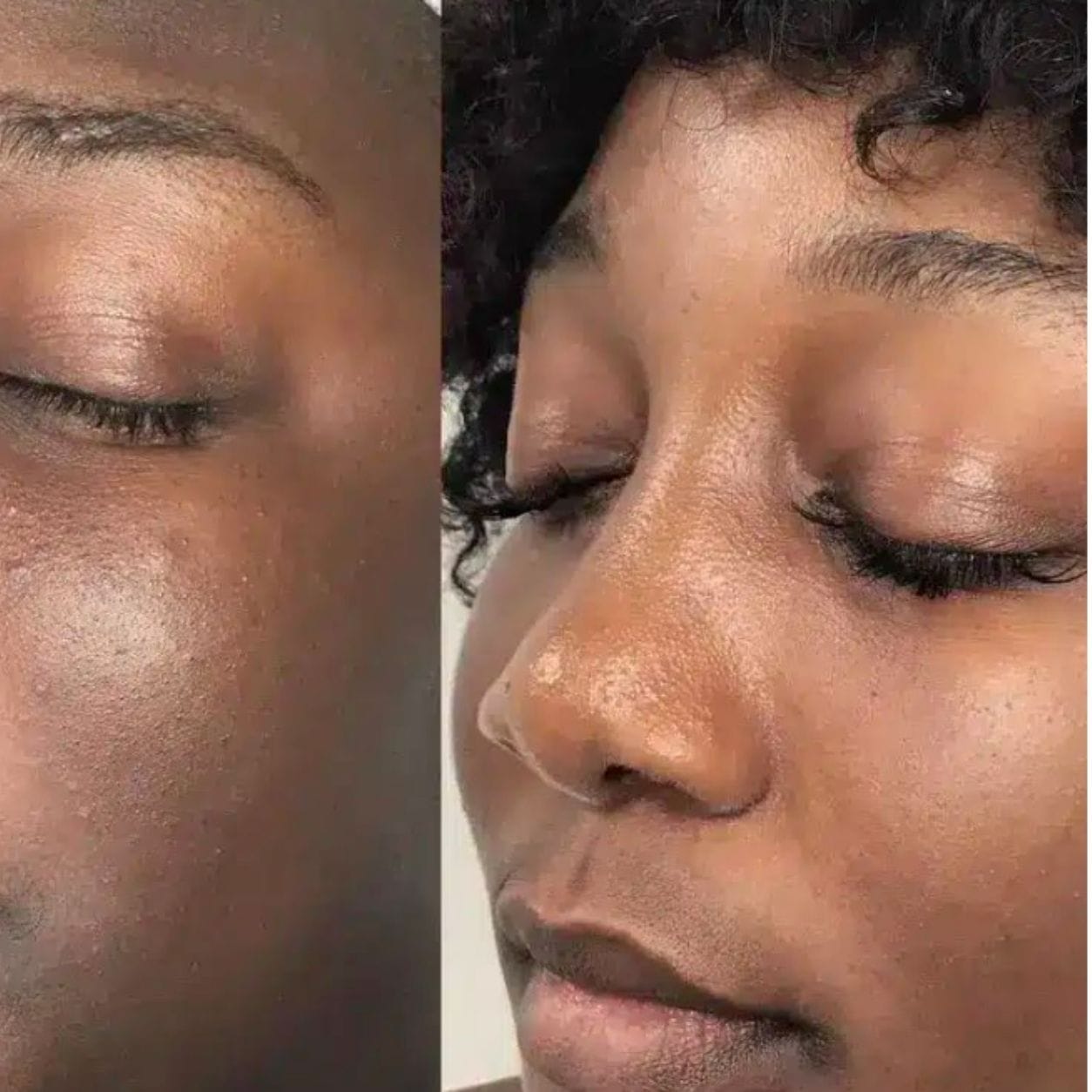 Customer photo review of Brightening Duo: Glow Face Wash + Glow Bar