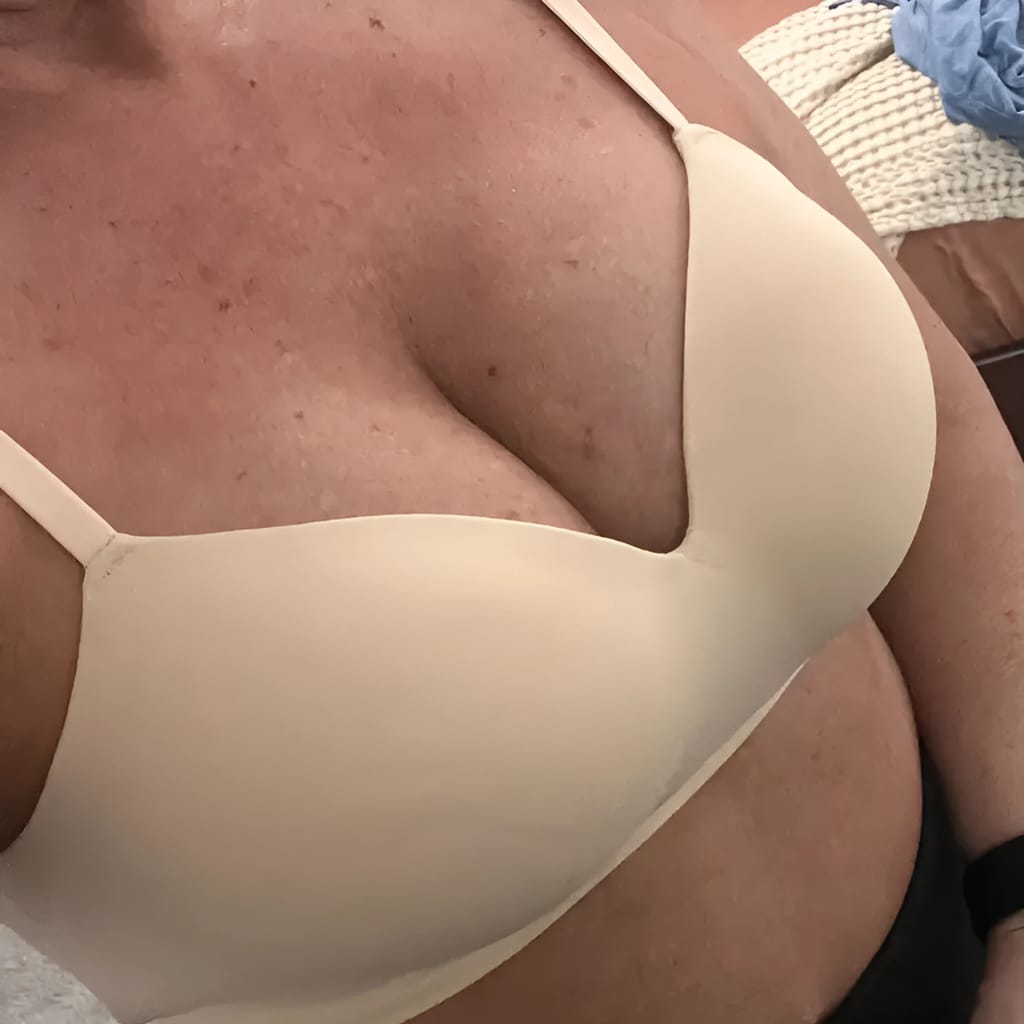 Customer photo review of Soutien-Gorge Ergonomique Vantyx™