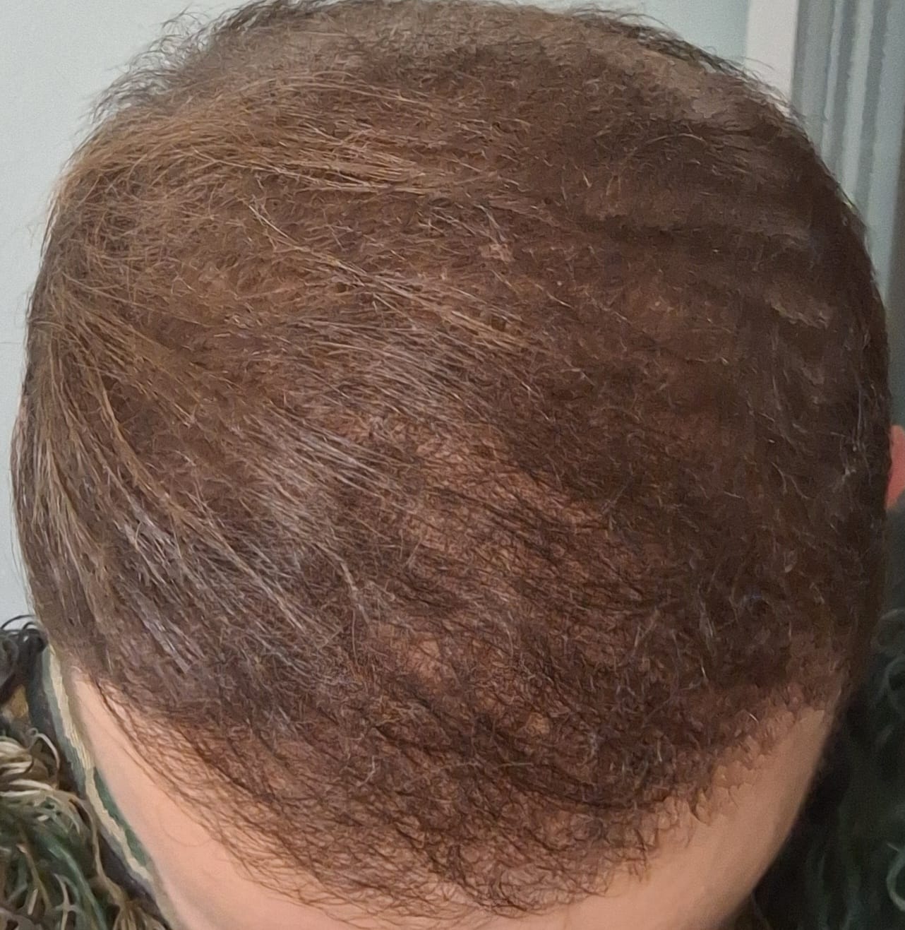 Customer photo review of 3 Dosen IMPERIO® Streuhaar + 1 Gratis Dose | (Sparangebot S)