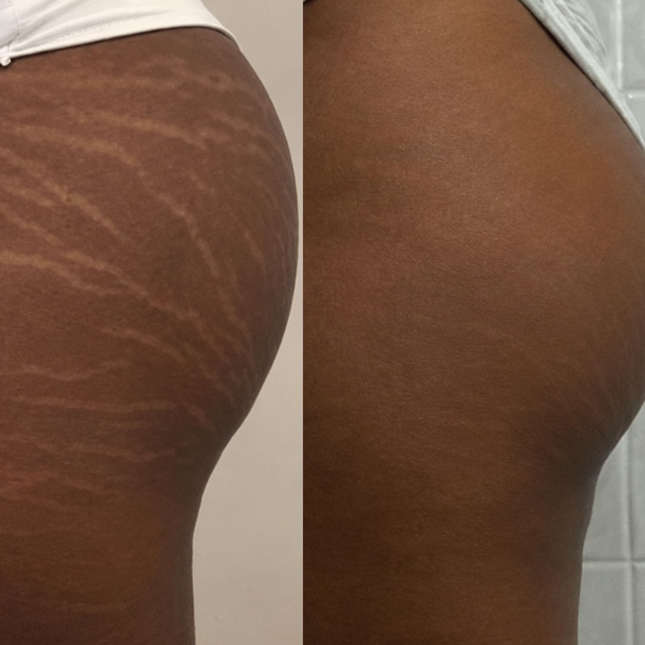 Customer photo review of Glowing Skin Routine: Glow Essentials