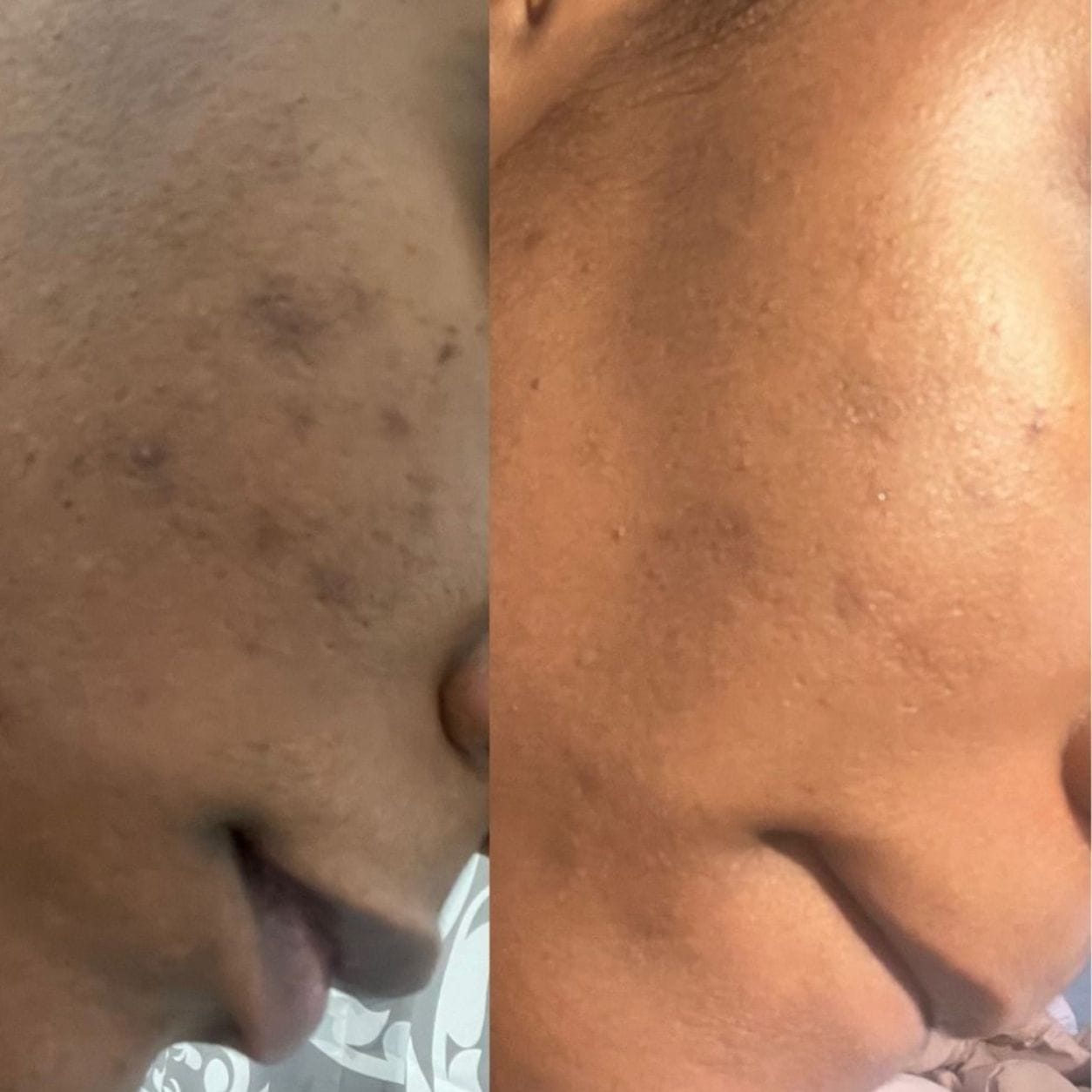 Customer photo review of Darkspots Glow Serum