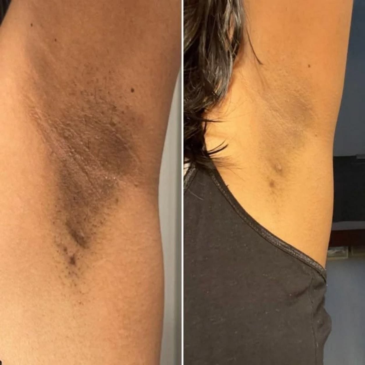 Customer photo review of Striae Glow Bar