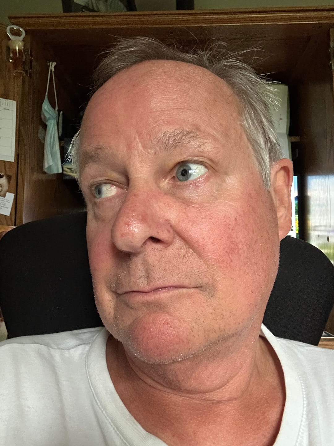 Customer photo review of REALief™ Dry Eye Wipes | 30