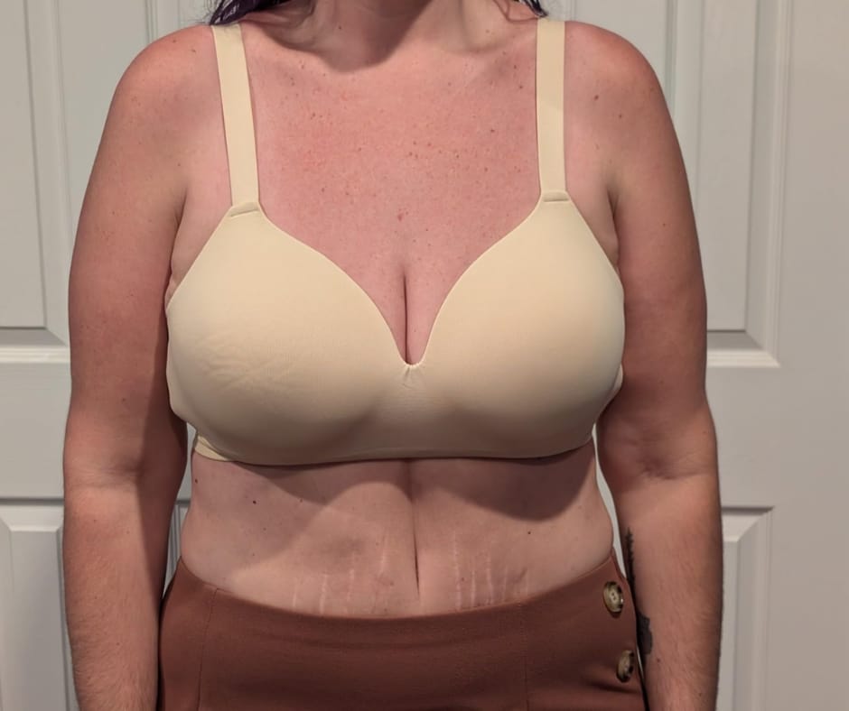 Customer photo review of Soutien-Gorge Ergonomique Vantyx™