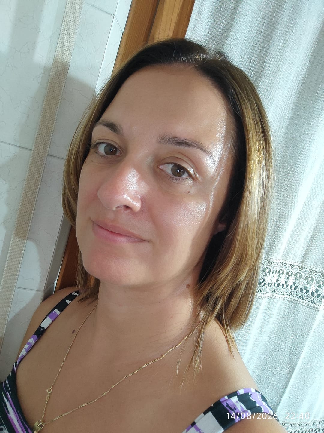 Customer photo review of BioChroma – Siero Coreano Effetto Lifting dalla Prima Applicazione