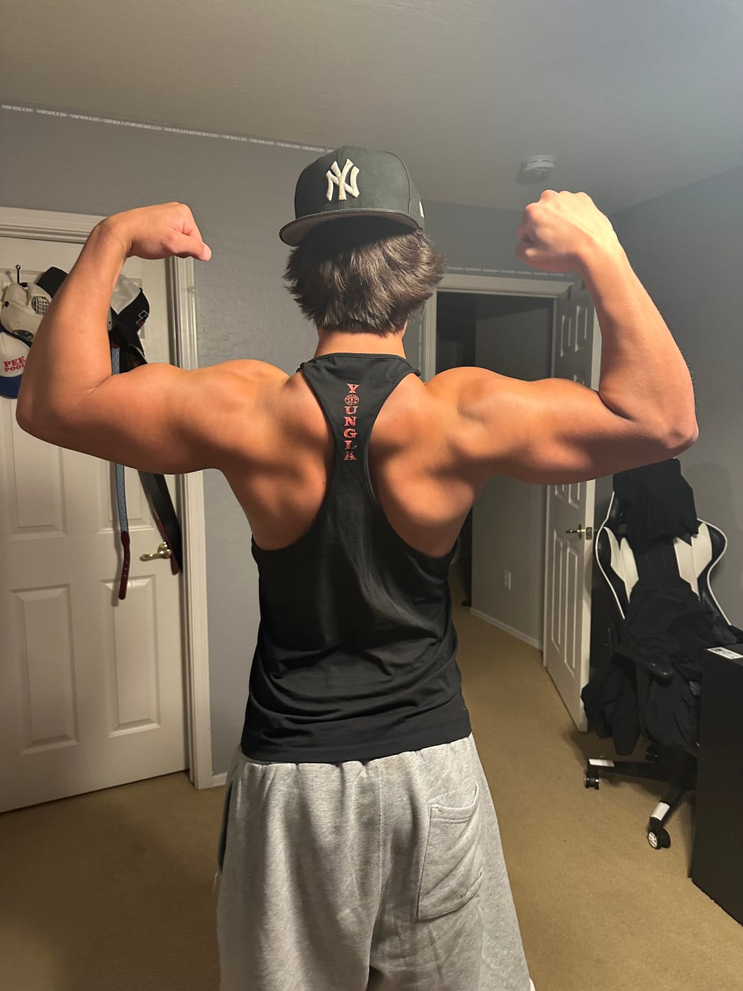 Customer photo review of 3062 - Gold's Glitch Stringers