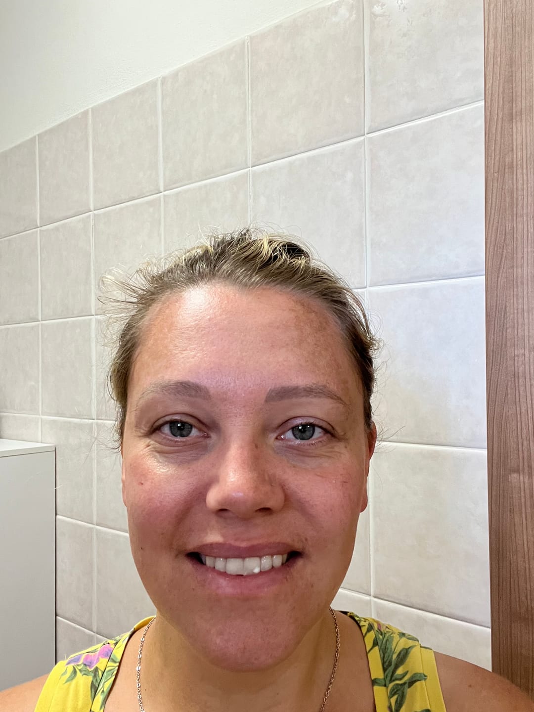 Customer photo review of BioChroma – Siero Coreano Effetto Lifting dalla Prima Applicazione