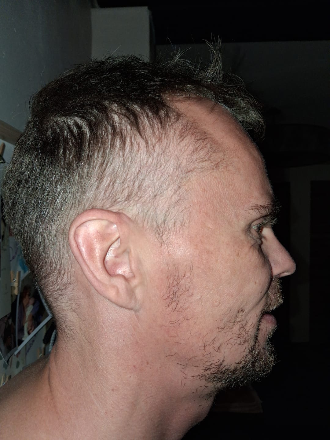 Customer photo review of Sérum Thorin | Huile de croissance de Barbe