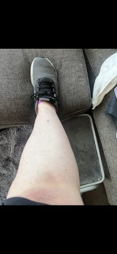 Customer photo review of Self Tanning | 150 Capsules for Sunless Skin Glow