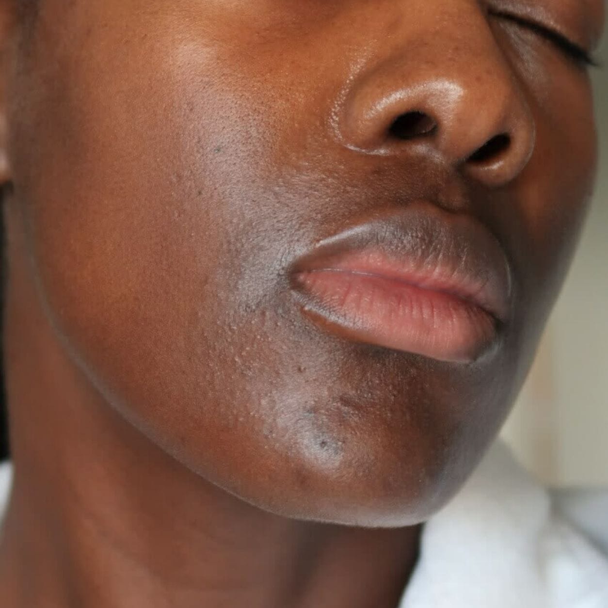 Customer photo review of Brightening Duo: Glow Face Wash + Glow Bar