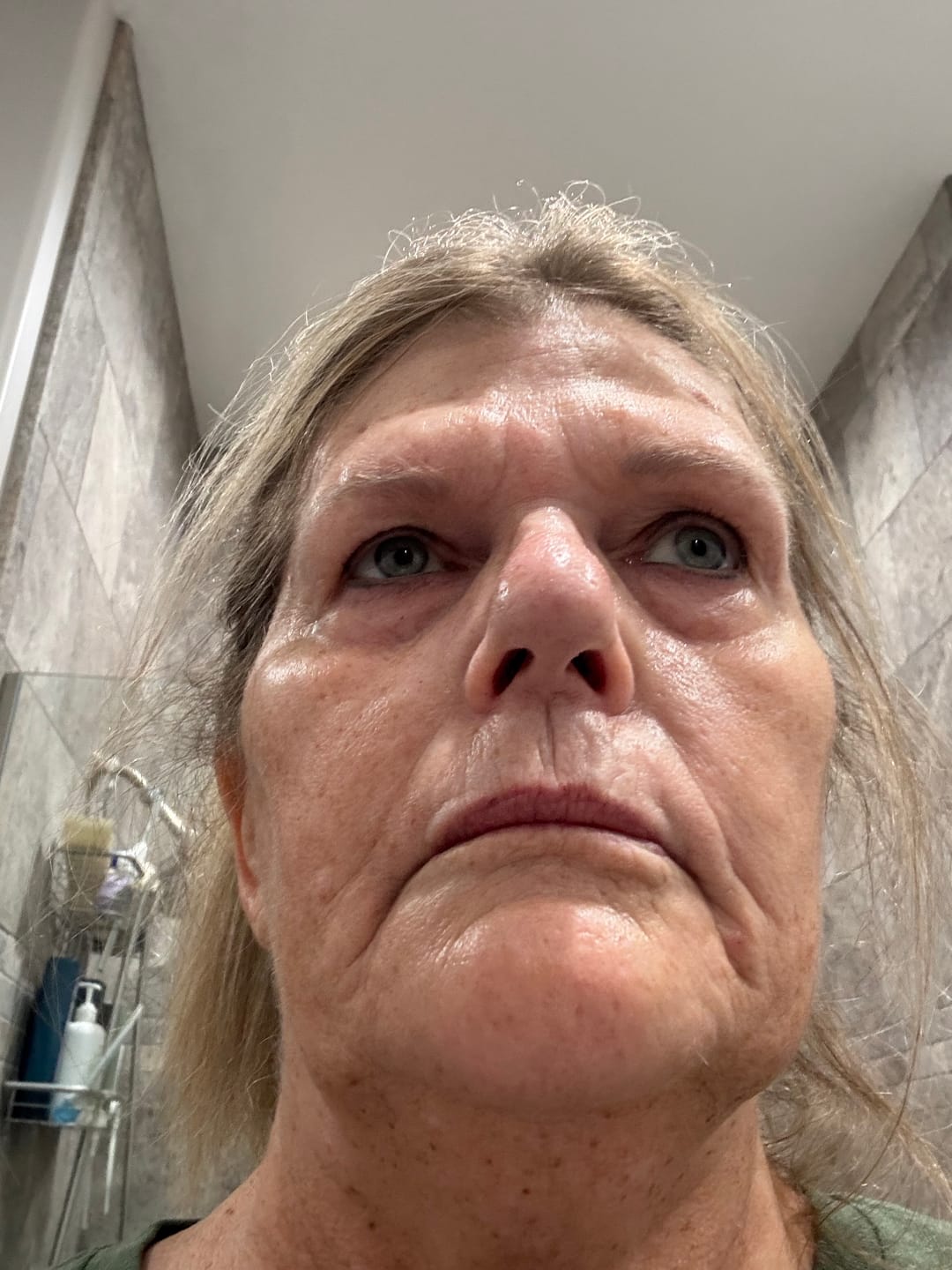Customer photo review of The Complete System for Mature Women’s Skin