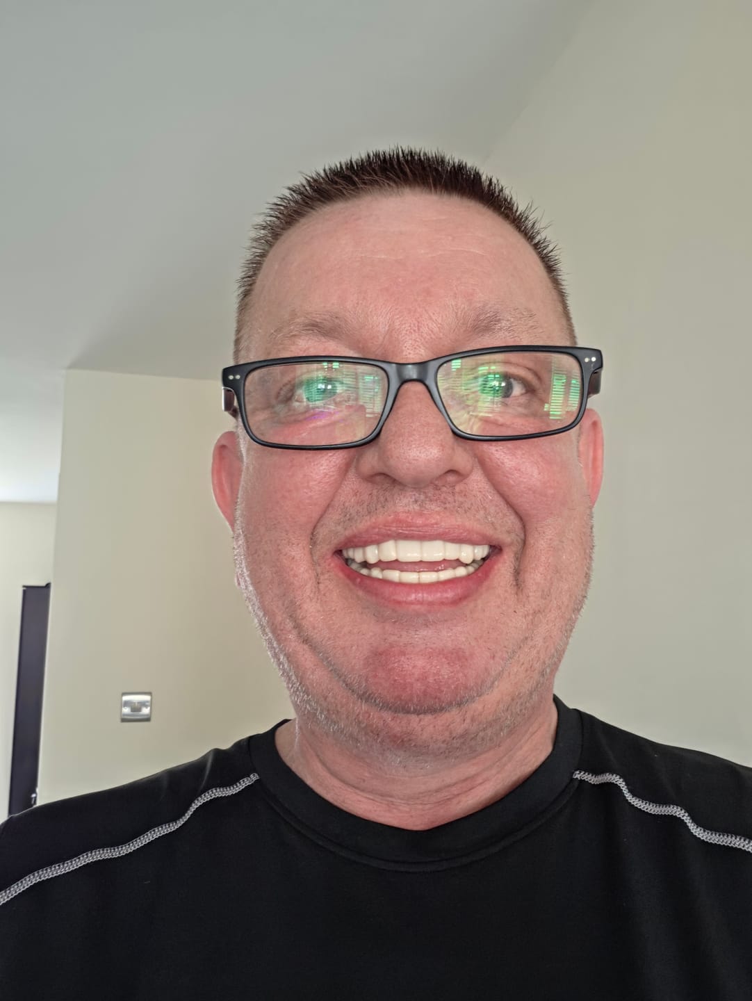 Customer photo review of Click-in Veneers 4.0