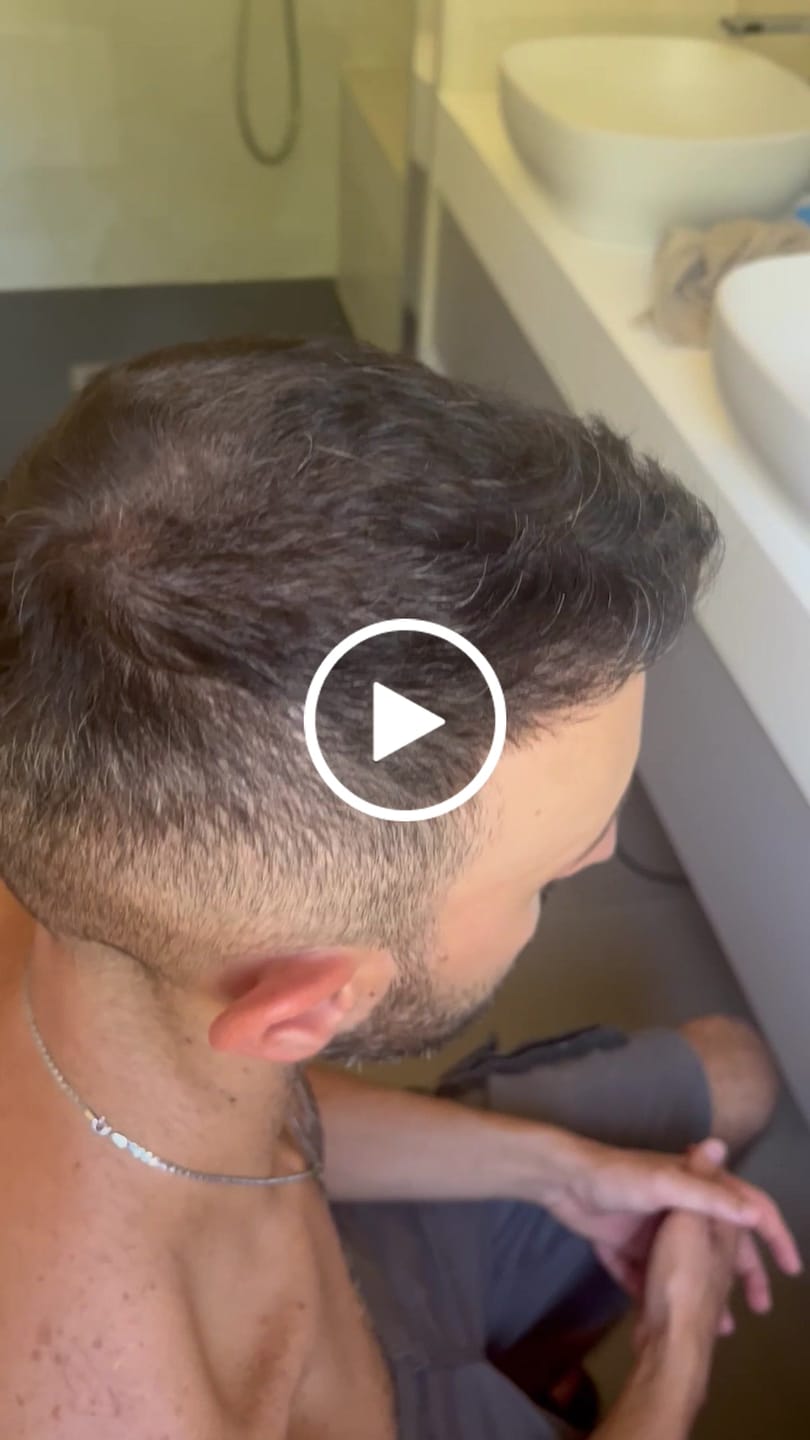 Customer video review of HairFiberPlus – Fibre di Cotone per Capelli 7g | Nero | Formato Prova (~15 giorni)
