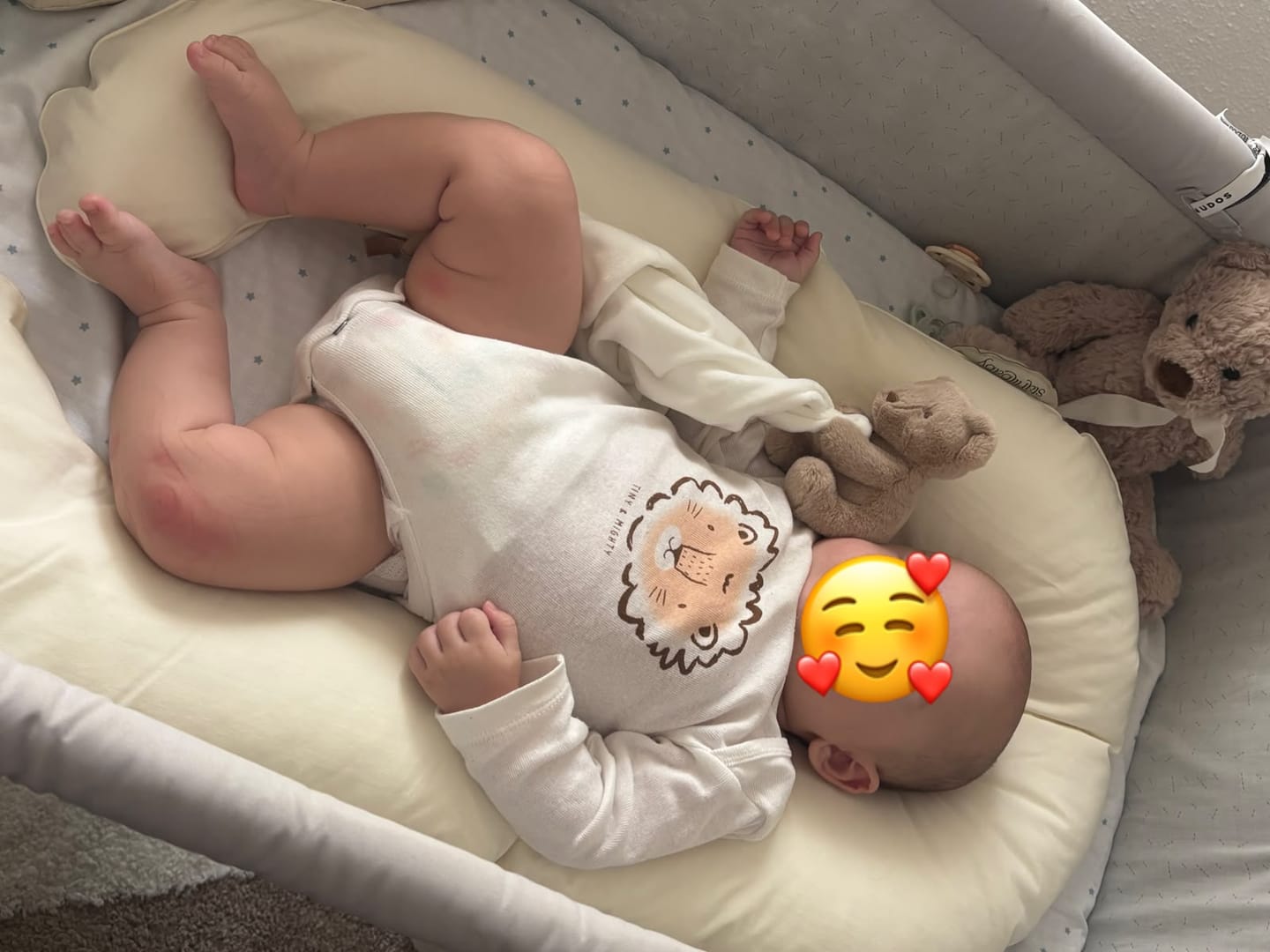 Customer photo review of PRE-VENTA | REDUCTOR STARLIT®️ - Simula el vientre materno