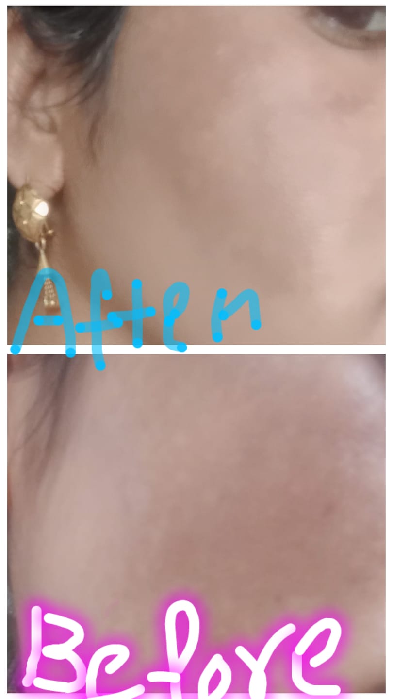 Customer photo review of Spectra Block Aqua Fluid Sunscreen SPF 60 PA+++