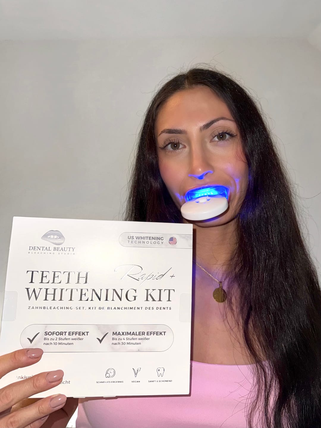 Customer photo review of Zahnbleaching-Set Rapid+ Dental Beauty - Teeth Whitening Kit™