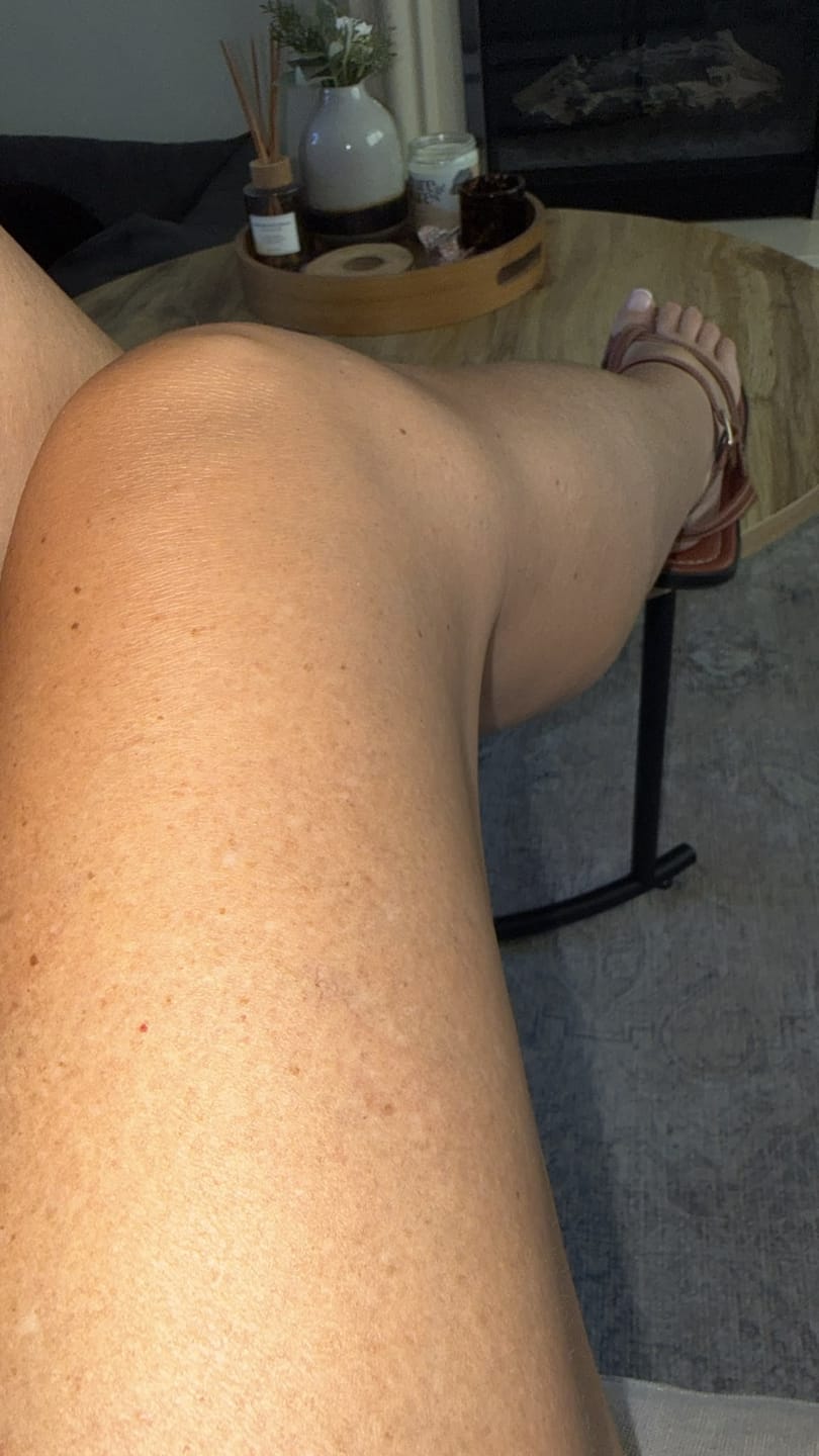 Customer photo review of NØRD BODY Peptide Body Oil