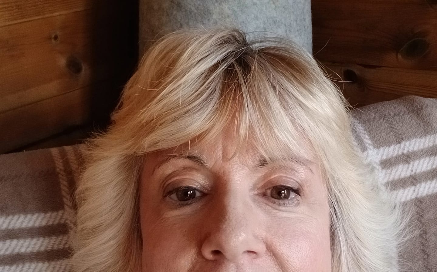 Customer photo review of Rosalique 3 in 1 Anti-Redness Miracle Formula SPF50