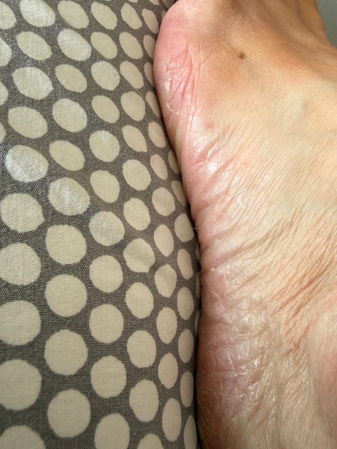 Customer photo review of Bioskin Duo Pack