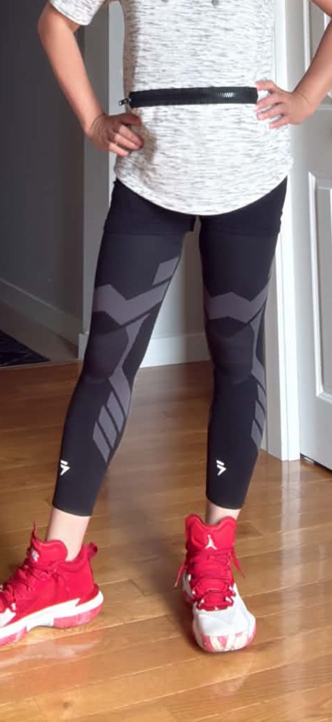 Customer photo review of Compression Sleeves V2 for Knees and Legs