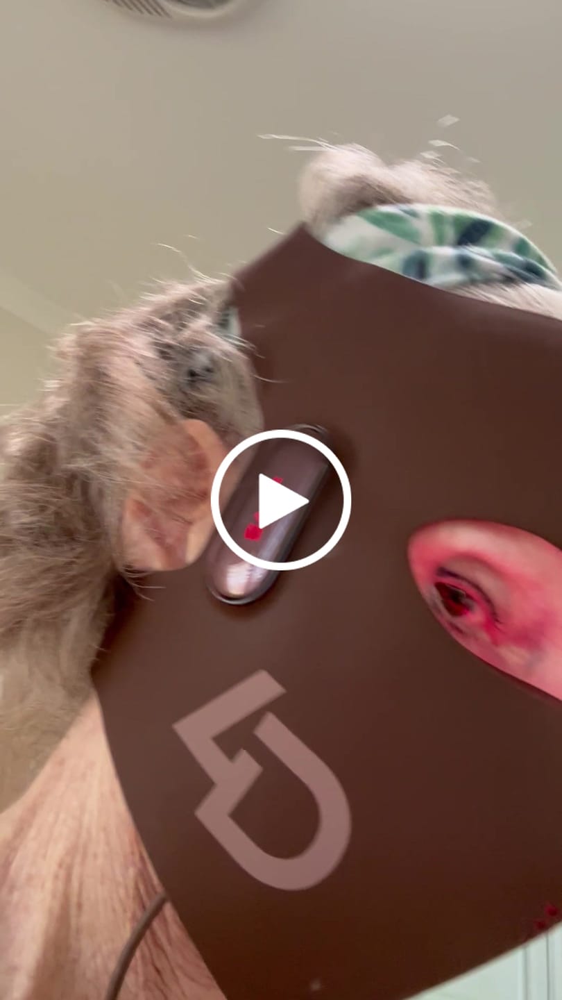 Customer video review of JOVS 4D Laser Light Therapy Mask
