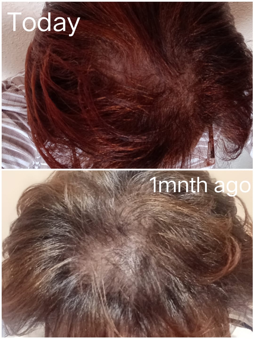 Customer photo review of Hair & Nail Herbs Tincture