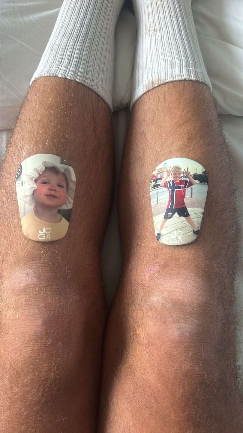 Customer photo review of Custom Shin Pads