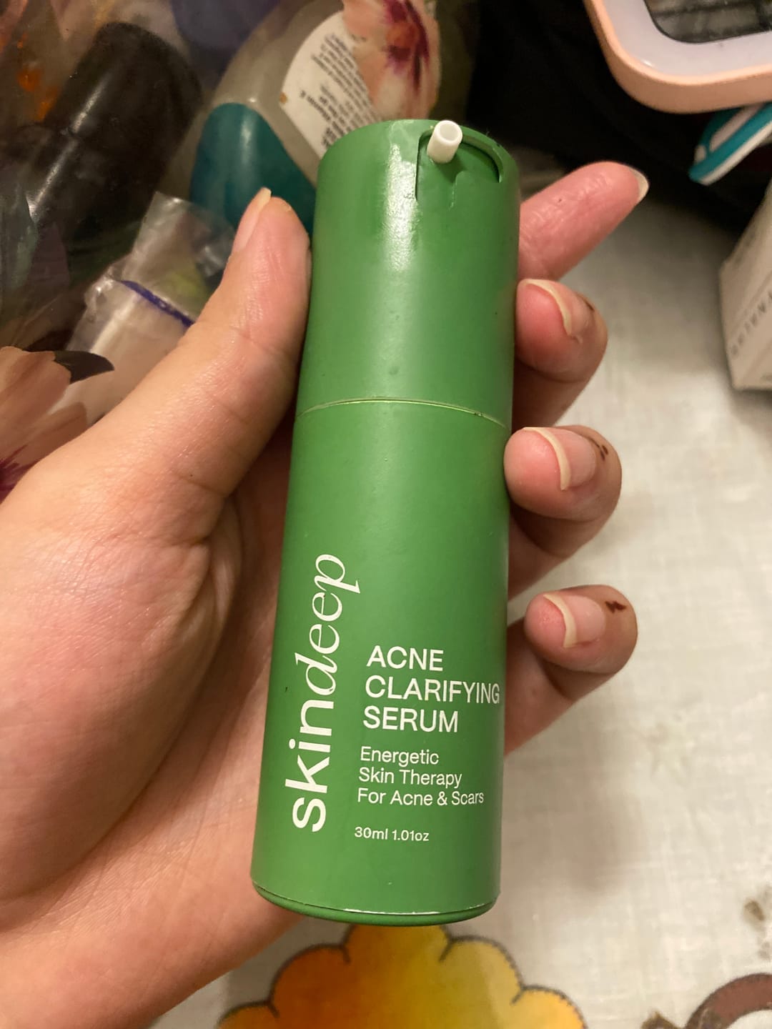 Customer photo review of ACNE CLARIFYING SERUM - Energetic Skin Therapy for Acne & Scars