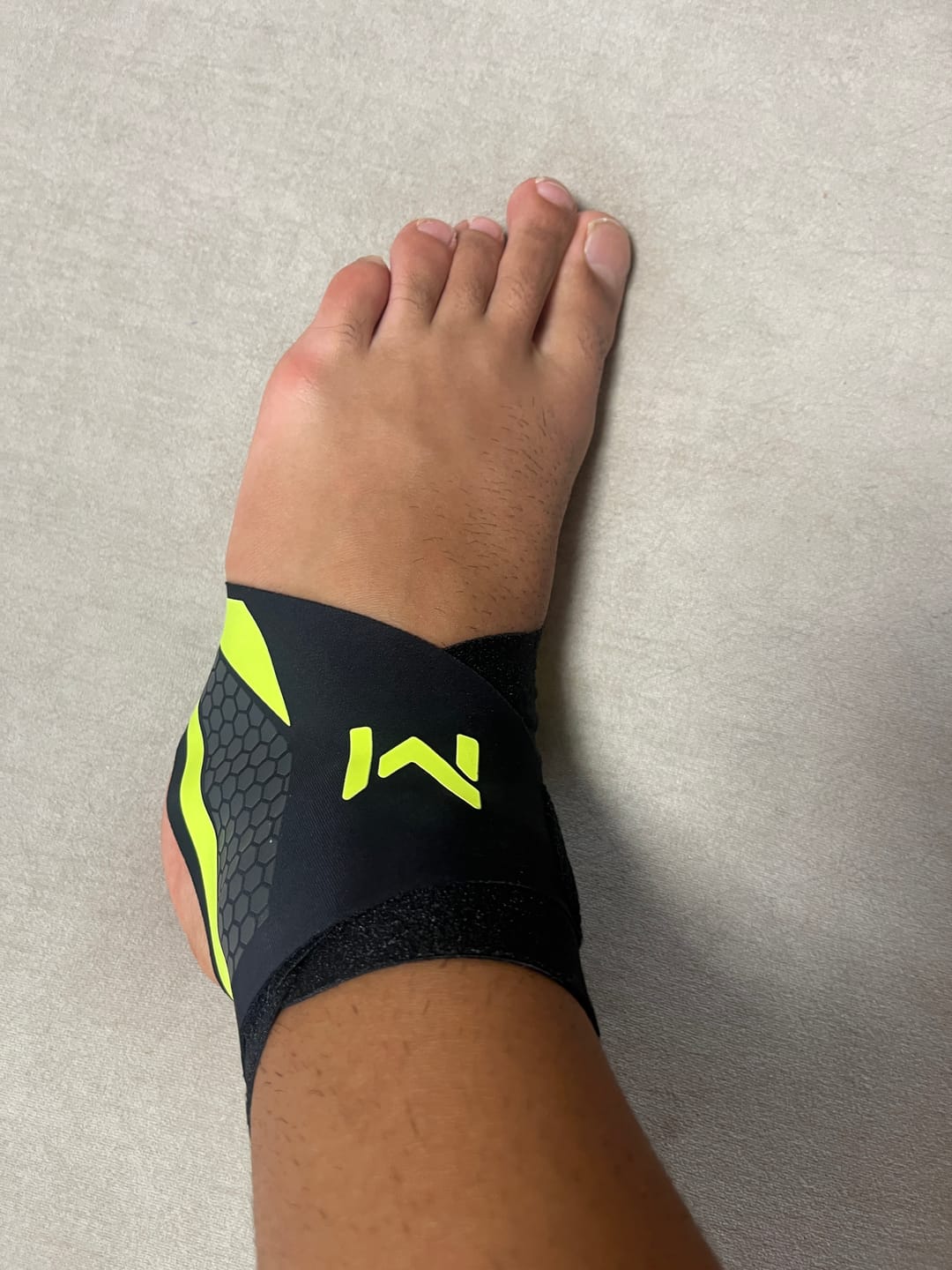 Customer photo review of MetaFit - Tobillera de Estabilidad y Protección