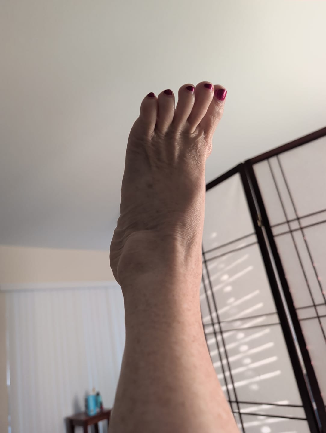 Customer photo review of GoodBone System