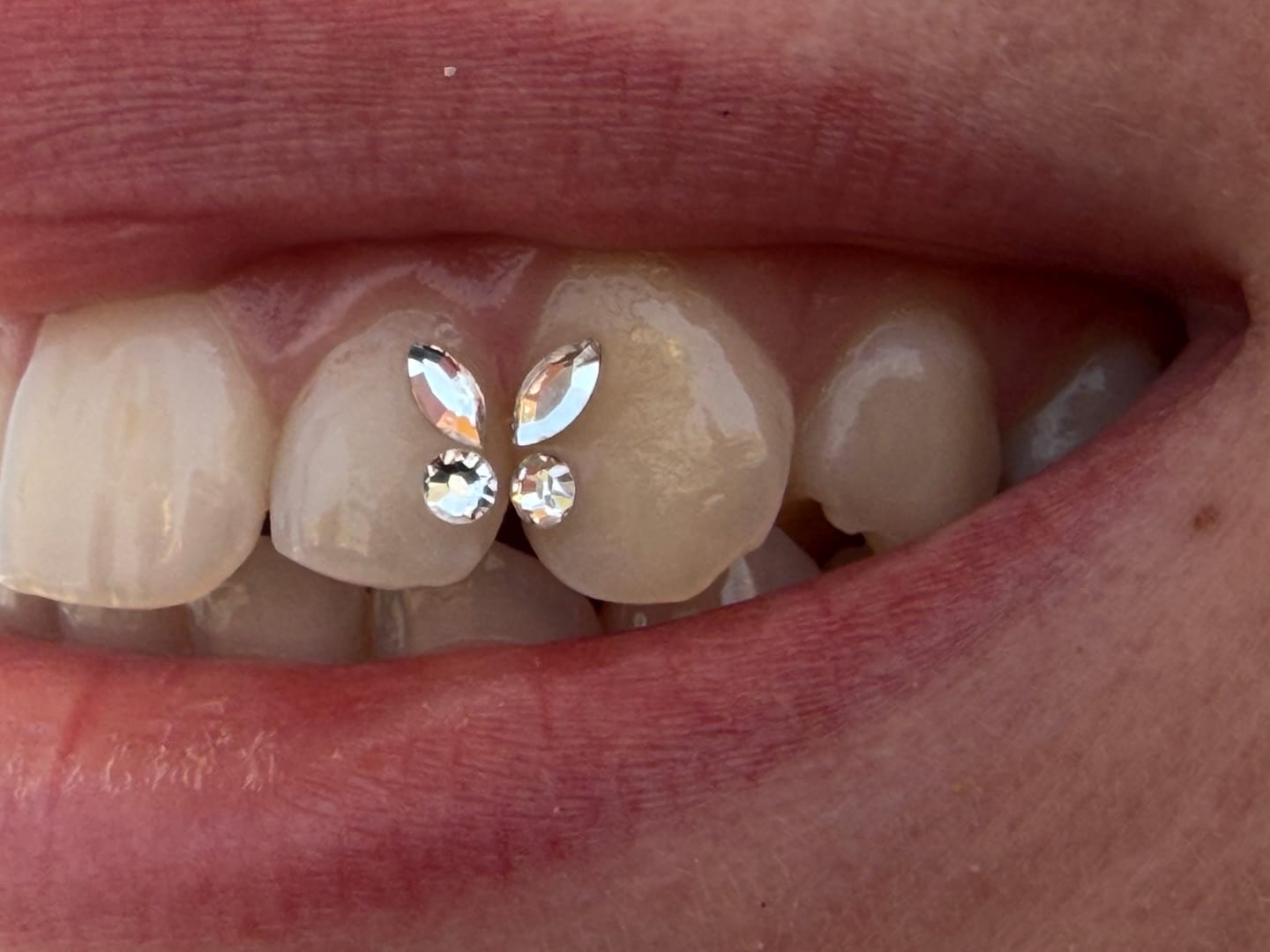 Customer photo review of Crystal Clear Butterfly Tooth Gem - Preciosa®
