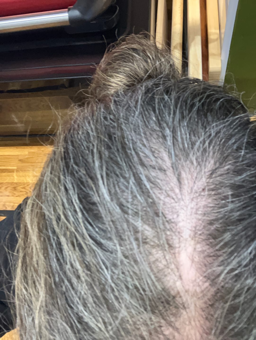 Customer photo review of Seb Natural Calming Serum