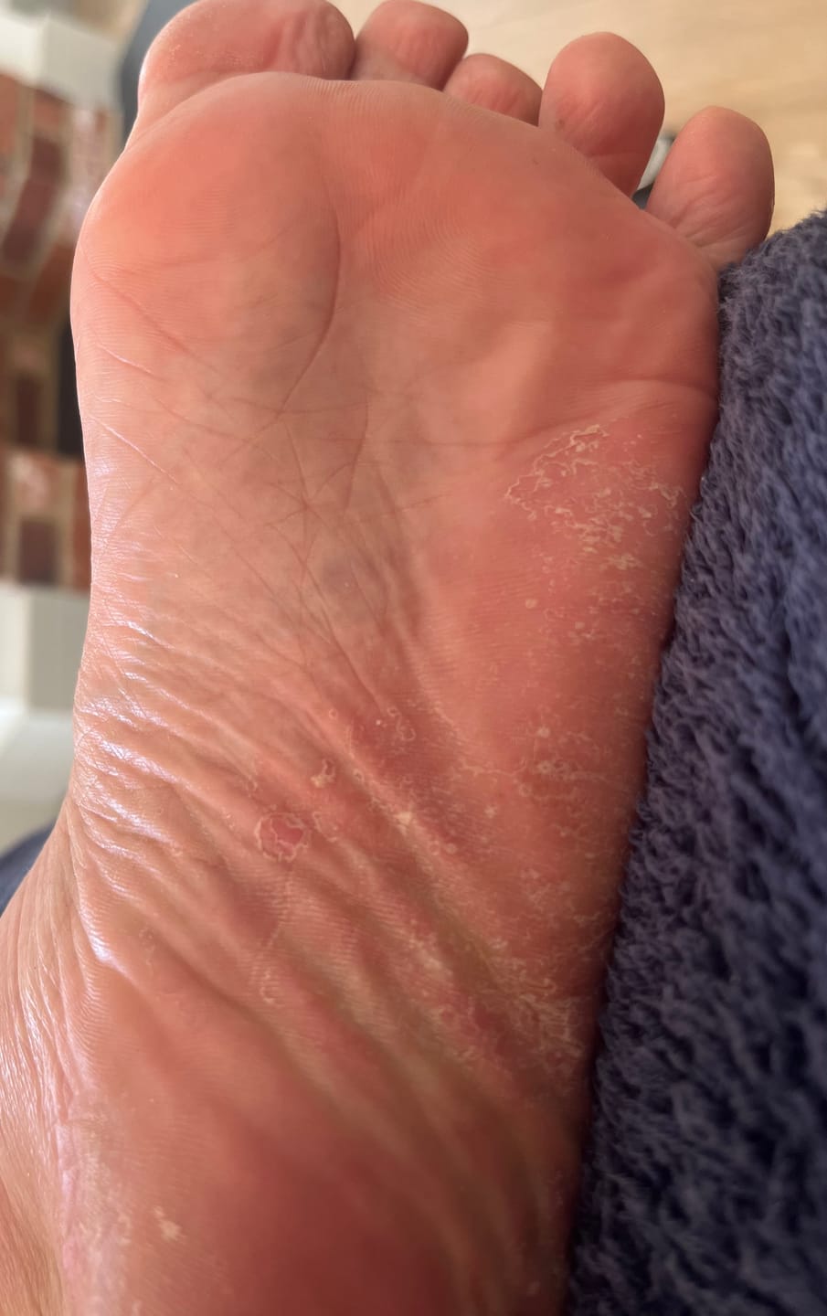 Customer photo review of Seb Natural Calming Serum