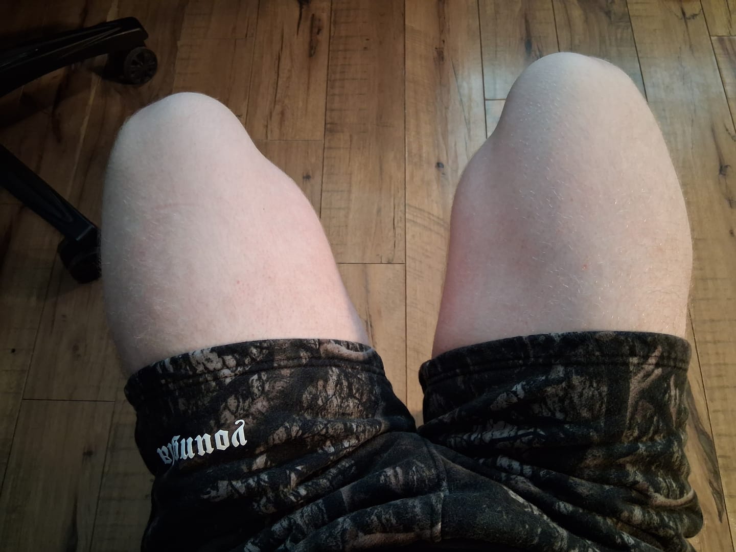Customer photo review of 1118 - Tree Camo Cotton Shorts