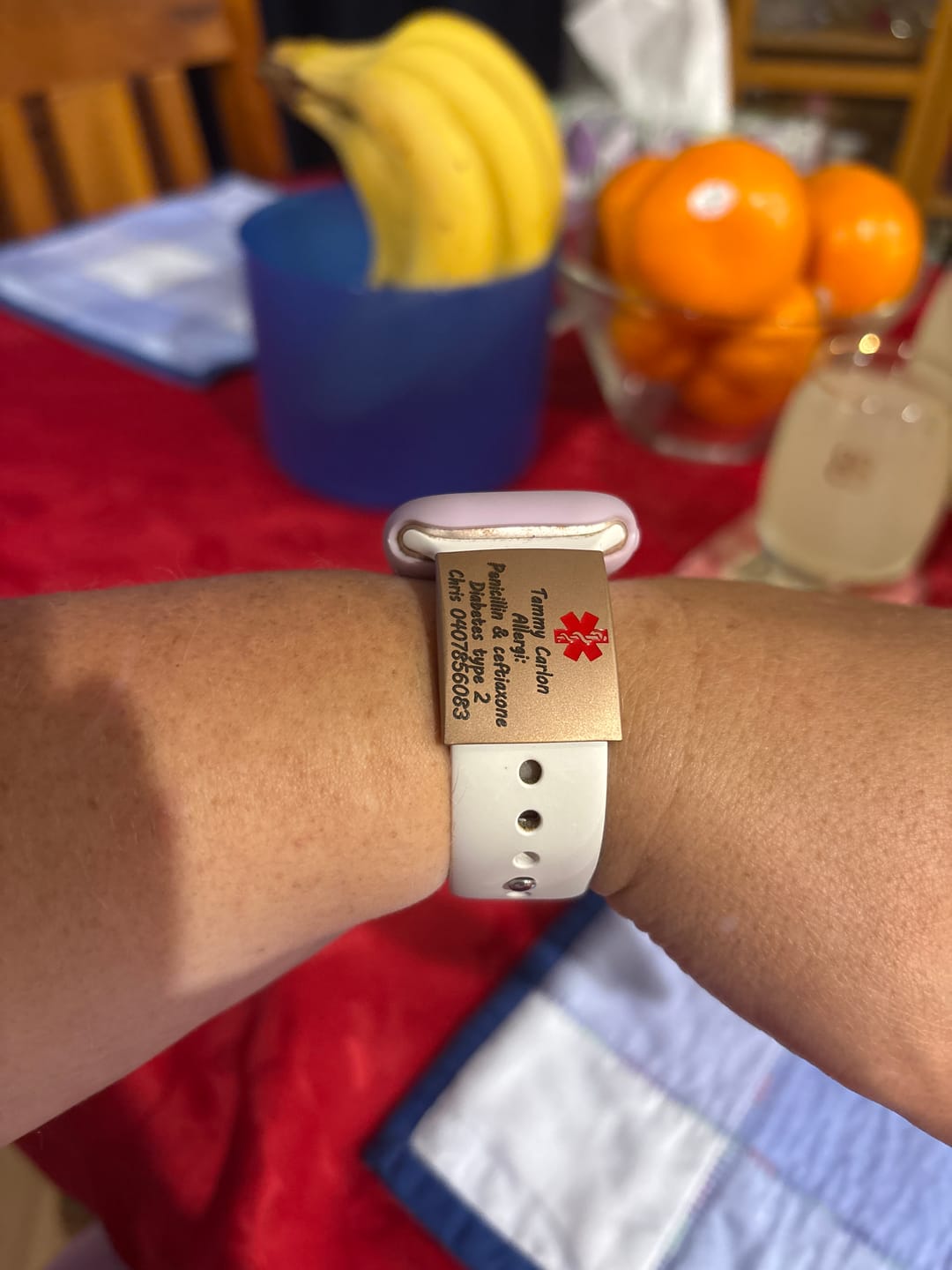 Customer photo review of Personalised ID Tag for Watch Band & Fitness Trackers
