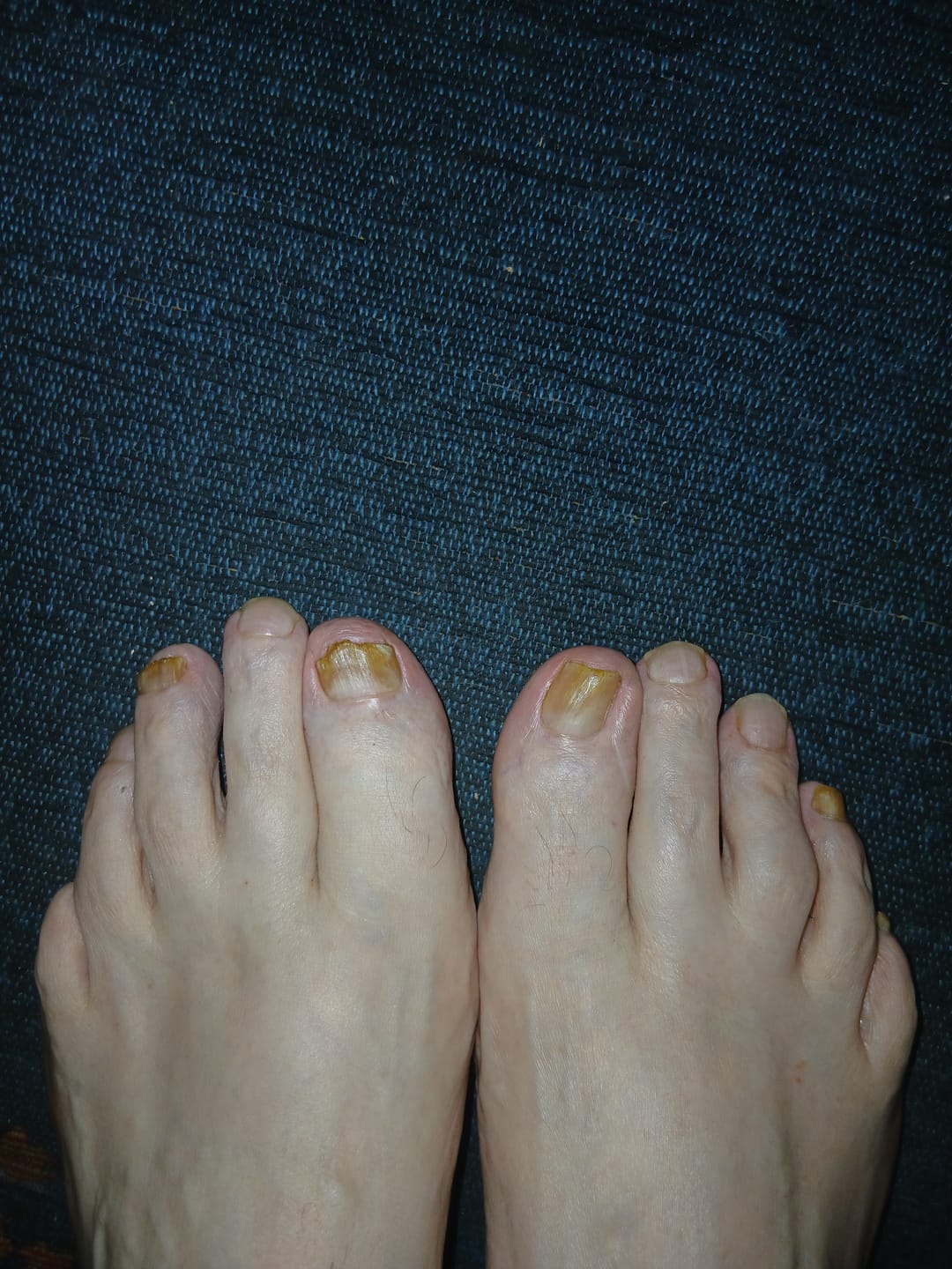 Customer photo review of Fungal Freedom