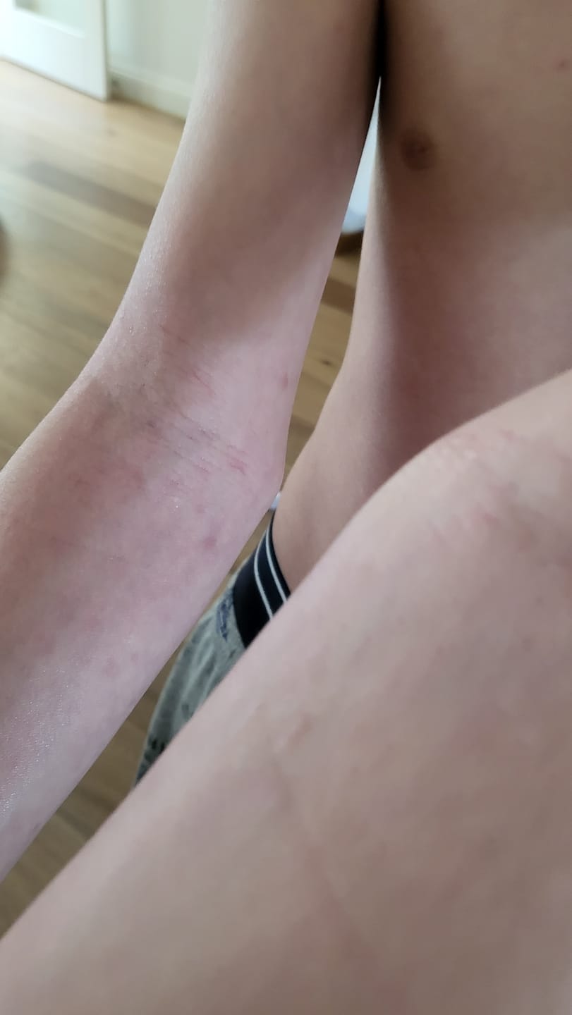 Customer photo review of Seb Natural Soothing Balm