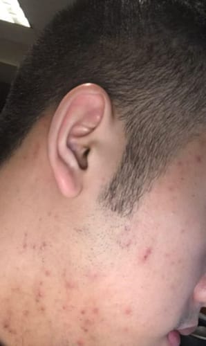Customer photo review of Skin Formula